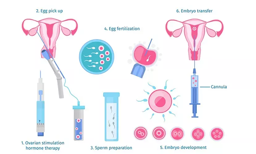 ivf schema